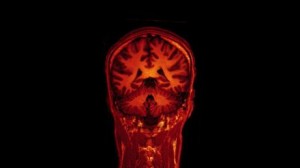 brain Opérationnel.brain scan